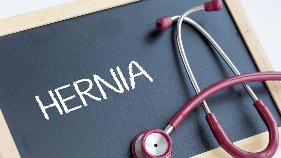 5 Signs You Have Hernia Mesh Complications